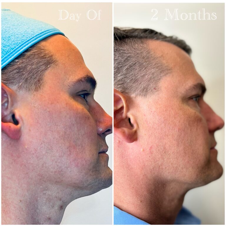 Ultra, 3D and Laser Coring