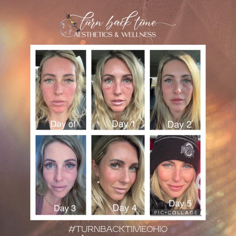 472508925_122118361790611573_8443480020167122187_n