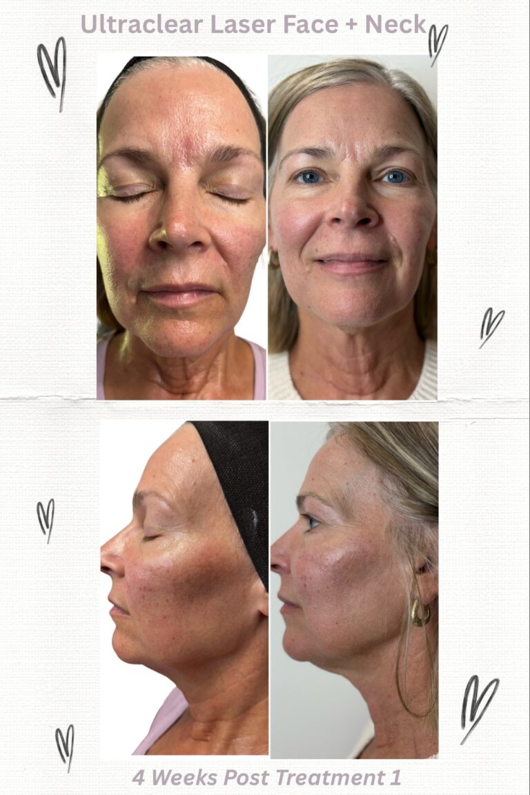 525846590_122150760956611573_6296974971428151541_n