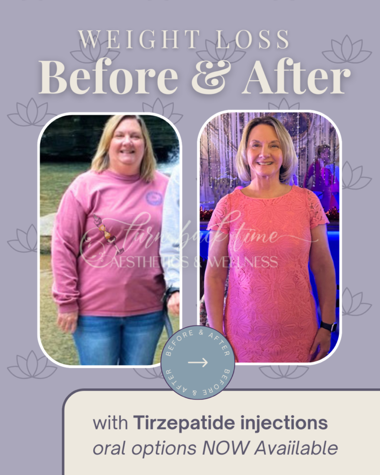 weightloss- 58 lbs lost