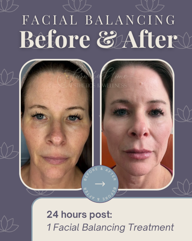 Facial Balancing